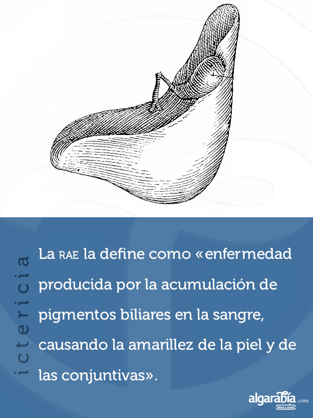 ictericia