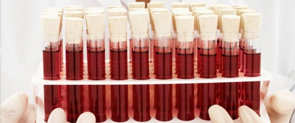 s53-ciencia-sangre